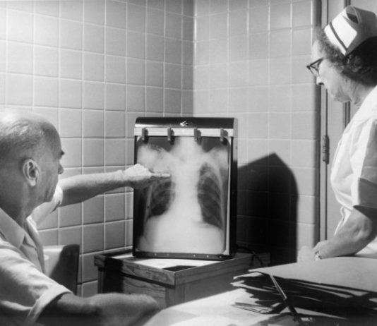 a man and a woman looking at a chest x - ray