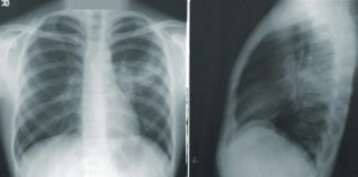 woman in black and white stripe shirt